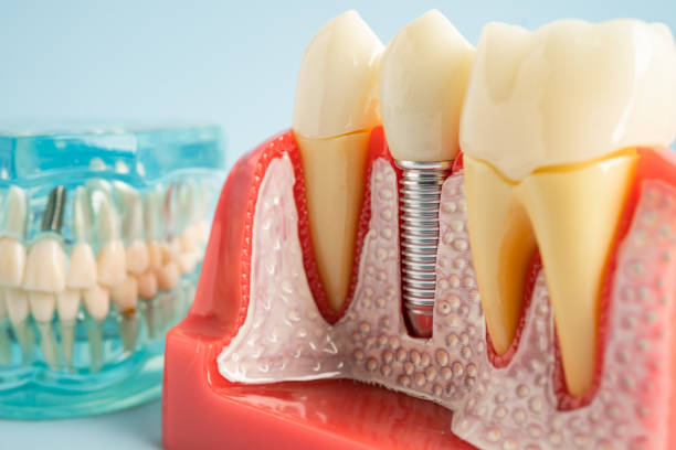 Best Tooth Extraction  in Titusville, FL